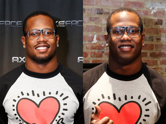 Von-Miller-Before-and-After
