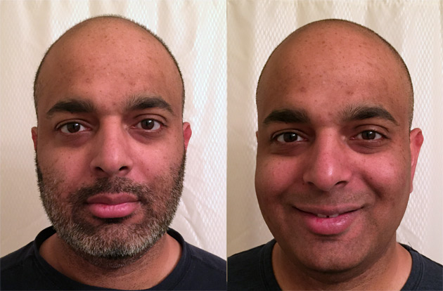 Sujeet - Before and After